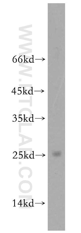 Western Blot (WB) analysis of HEK-293 cells using BIN3 Polyclonal antibody (20186-1-AP)