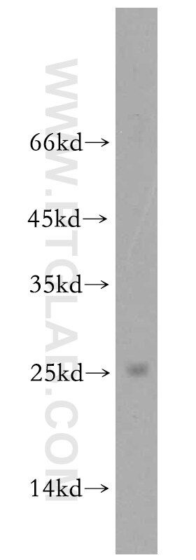 Western Blot (WB) analysis of HEK-293 cells using BIN3 Polyclonal antibody (20186-1-AP)