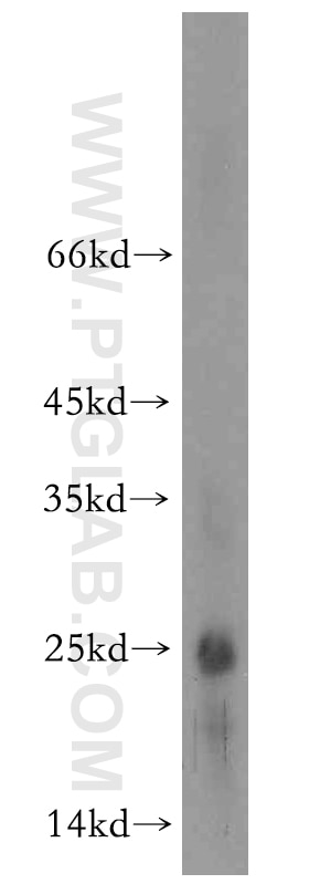 Western Blot (WB) analysis of A375 cells using BIN3 Polyclonal antibody (20186-1-AP)