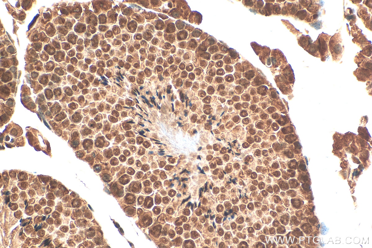 Immunohistochemistry (IHC) staining of mouse testis tissue using cIAP1 Polyclonal antibody (10022-1-AP)