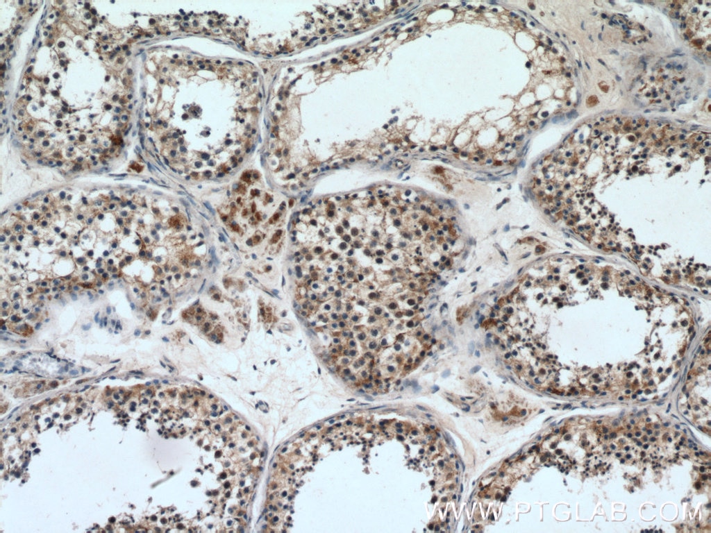 Immunohistochemistry (IHC) staining of human testis tissue using cIAP1 Polyclonal antibody (10022-1-AP)