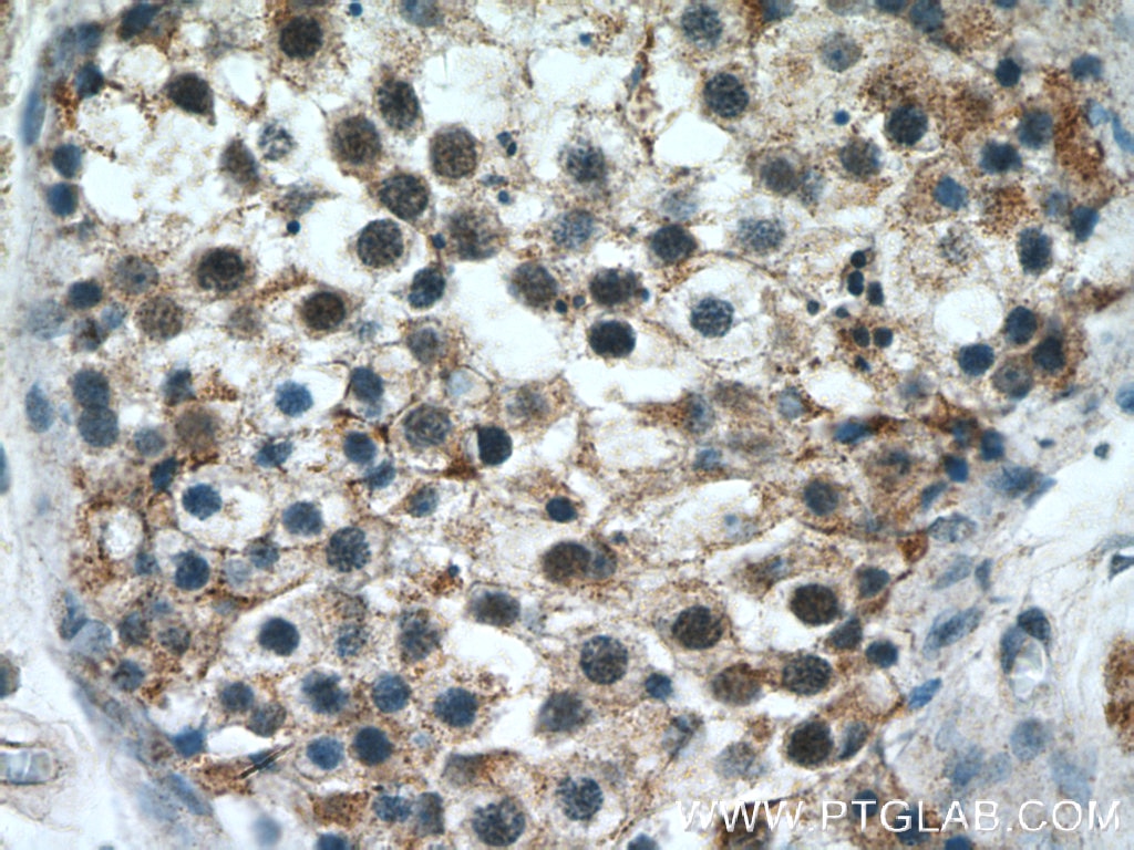 Immunohistochemistry (IHC) staining of human testis tissue using cIAP1 Polyclonal antibody (10022-1-AP)