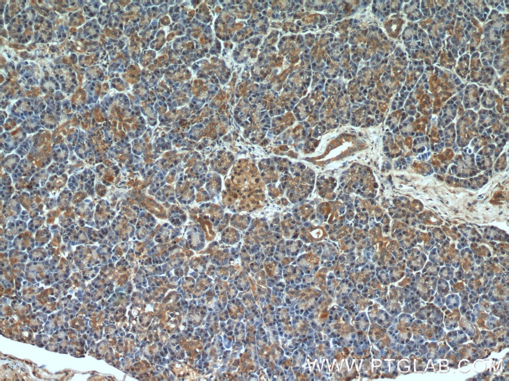 IHC staining of human pancreas using 10022-1-AP