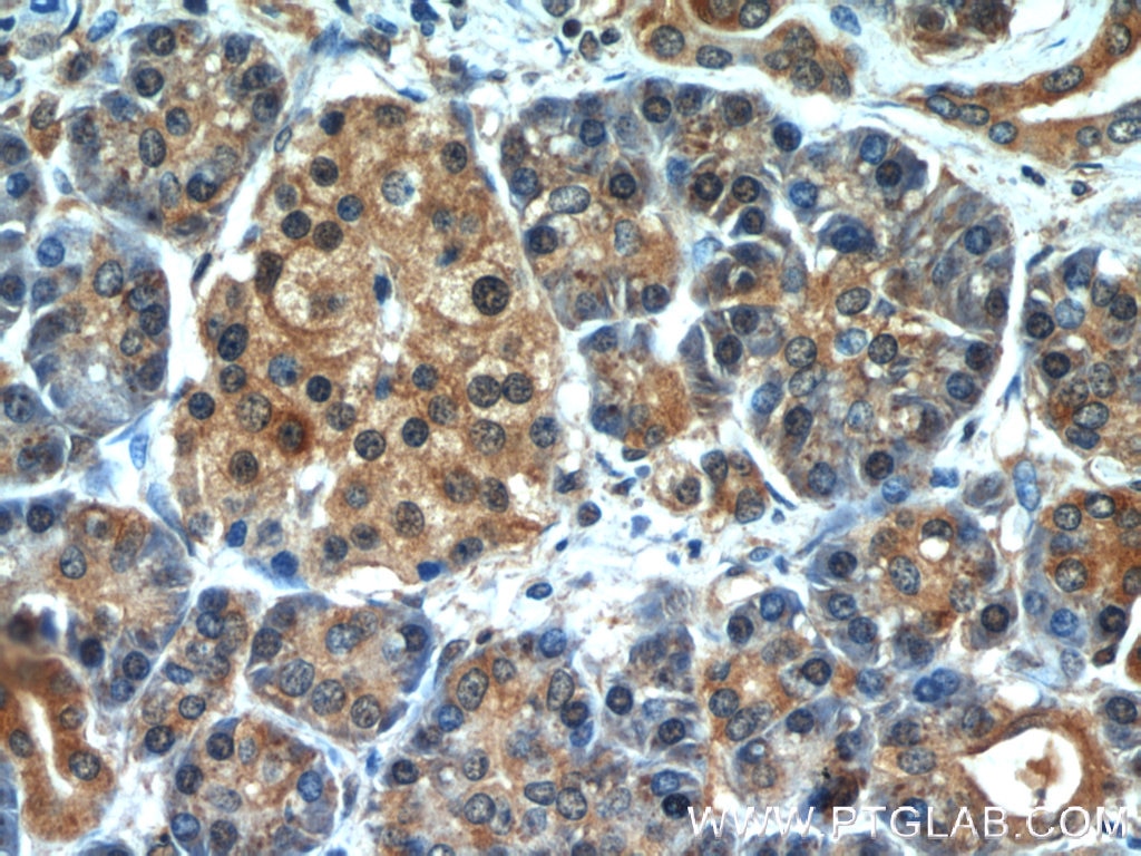 Immunohistochemistry (IHC) staining of human pancreas tissue using cIAP1 Polyclonal antibody (10022-1-AP)