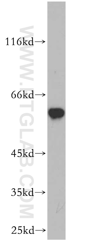 Western Blot (WB) analysis of mouse skeletal muscle tissue using cIAP1 Polyclonal antibody (10022-1-AP)