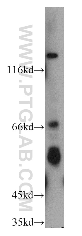 Western Blot (WB) analysis of mouse testis tissue using cIAP1 Polyclonal antibody (10022-1-AP)