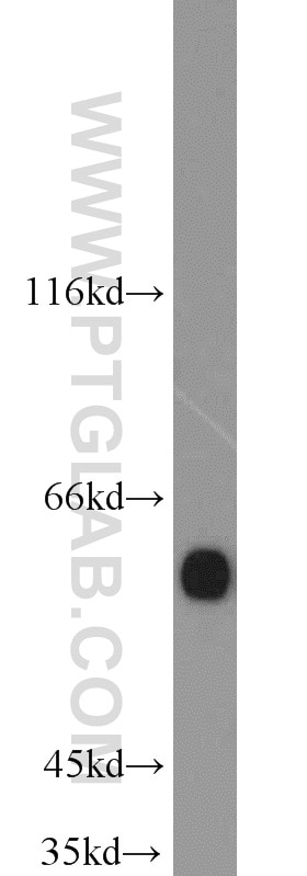 Western Blot (WB) analysis of mouse liver tissue using cIAP1 Polyclonal antibody (10022-1-AP)