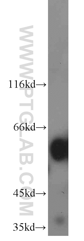 Western Blot (WB) analysis of mouse brain tissue using cIAP1 Polyclonal antibody (10022-1-AP)