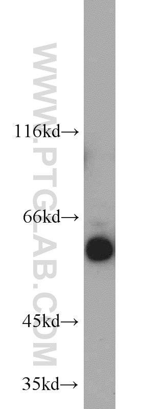 Western Blot (WB) analysis of Jurkat cells using cIAP1 Polyclonal antibody (10022-1-AP)