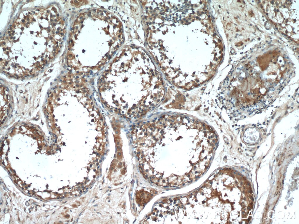 IHC staining of human testis using 24304-1-AP