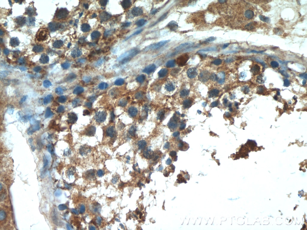 Immunohistochemistry (IHC) staining of human testis tissue using cIAP2 Polyclonal antibody (24304-1-AP)