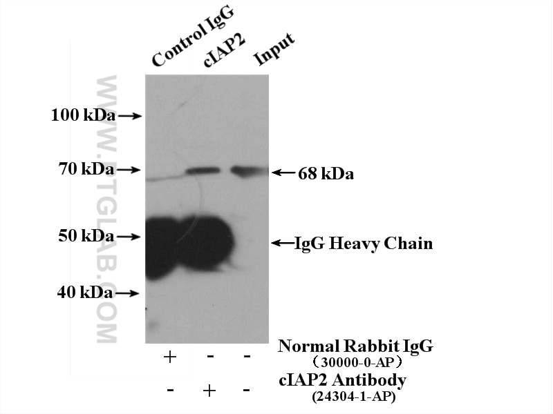 Immunoprecipitation (IP) experiment of Daudi cells using cIAP2 Polyclonal antibody (24304-1-AP)