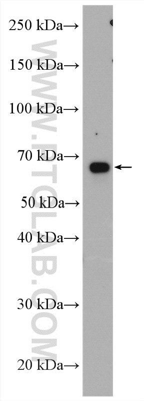 Western Blot (WB) analysis of RAW 264.7 cells using cIAP2 Polyclonal antibody (24304-1-AP)