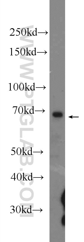 Western Blot (WB) analysis of U-937 cells using cIAP2 Polyclonal antibody (24304-1-AP)