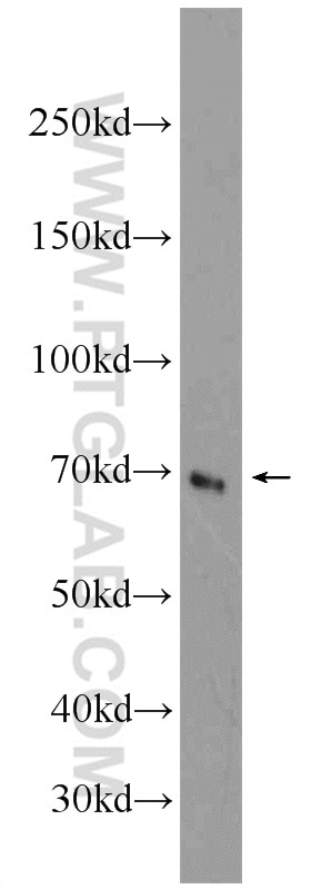 Western Blot (WB) analysis of HeLa cells using cIAP2 Polyclonal antibody (24304-1-AP)
