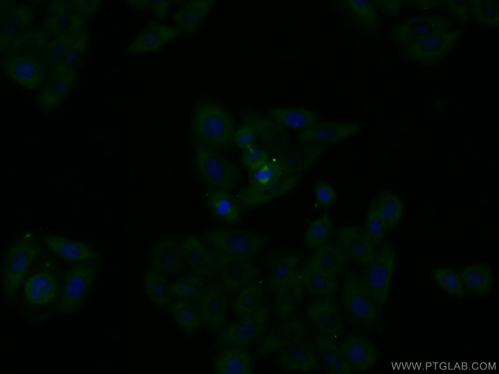 Immunofluorescence (IF) / fluorescent staining of HeLa cells using SURVIVIN-Specific Polyclonal antibody (19119-1-AP)
