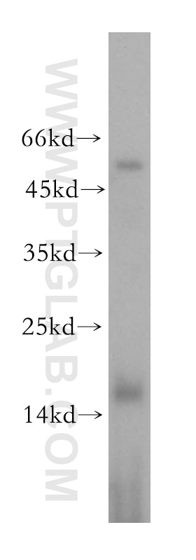 Western Blot (WB) analysis of HeLa cells using SURVIVIN-Specific Polyclonal antibody (19119-1-AP)