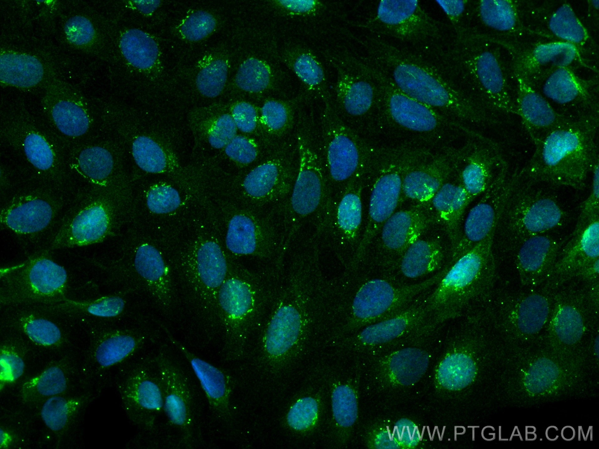 Immunofluorescence (IF) / fluorescent staining of U2OS cells using BIRC6 Polyclonal antibody (29760-1-AP)