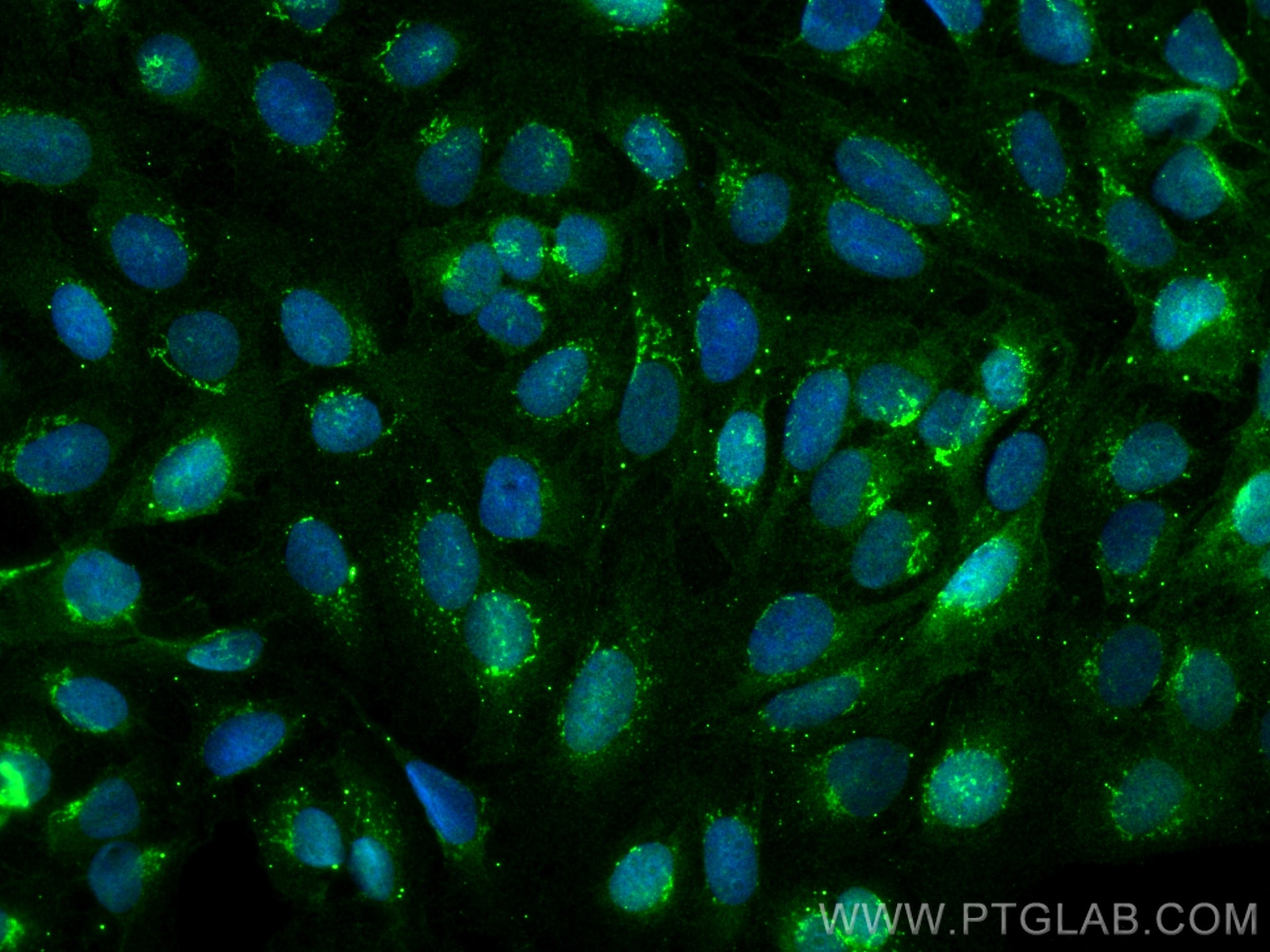 IF Staining of U2OS using 29760-1-AP