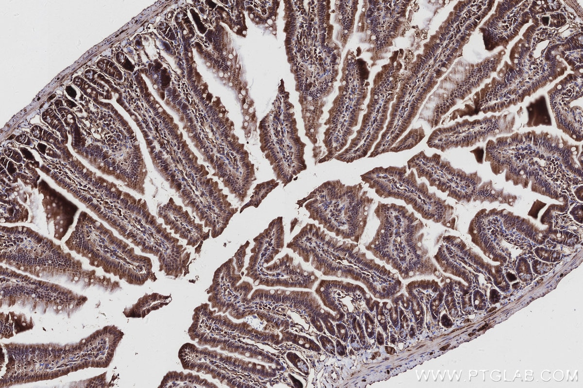 IHC staining of mouse small intestine using 29760-1-AP Immunohistochemistry (IHC) staining of mouse small intestine tissue using BIRC6 Polyclonal antibody (29760-1-AP)