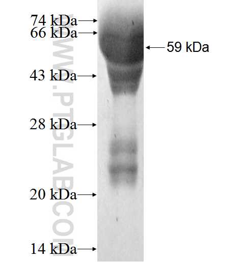 BIRC7 fusion protein Ag1861 SDS-PAGE