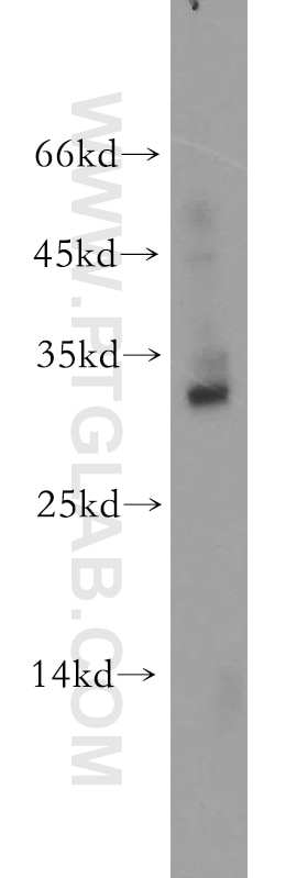 Western Blot (WB) analysis of mouse brain tissue using BIRC8 Polyclonal antibody (20144-1-AP)