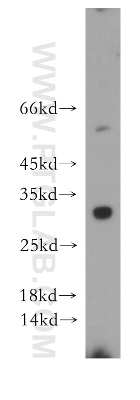 Western Blot (WB) analysis of human brain tissue using BIRC8 Polyclonal antibody (20144-1-AP)