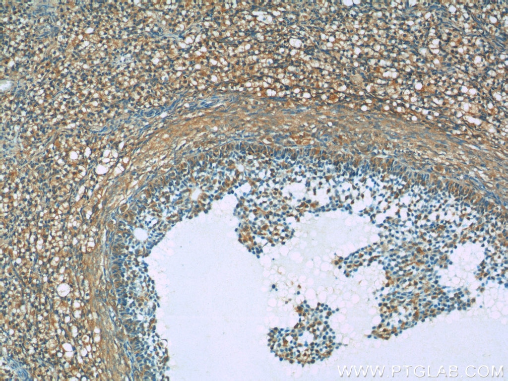 Immunohistochemistry (IHC) staining of human ovary tissue using BIVM Polyclonal antibody (25432-1-AP)