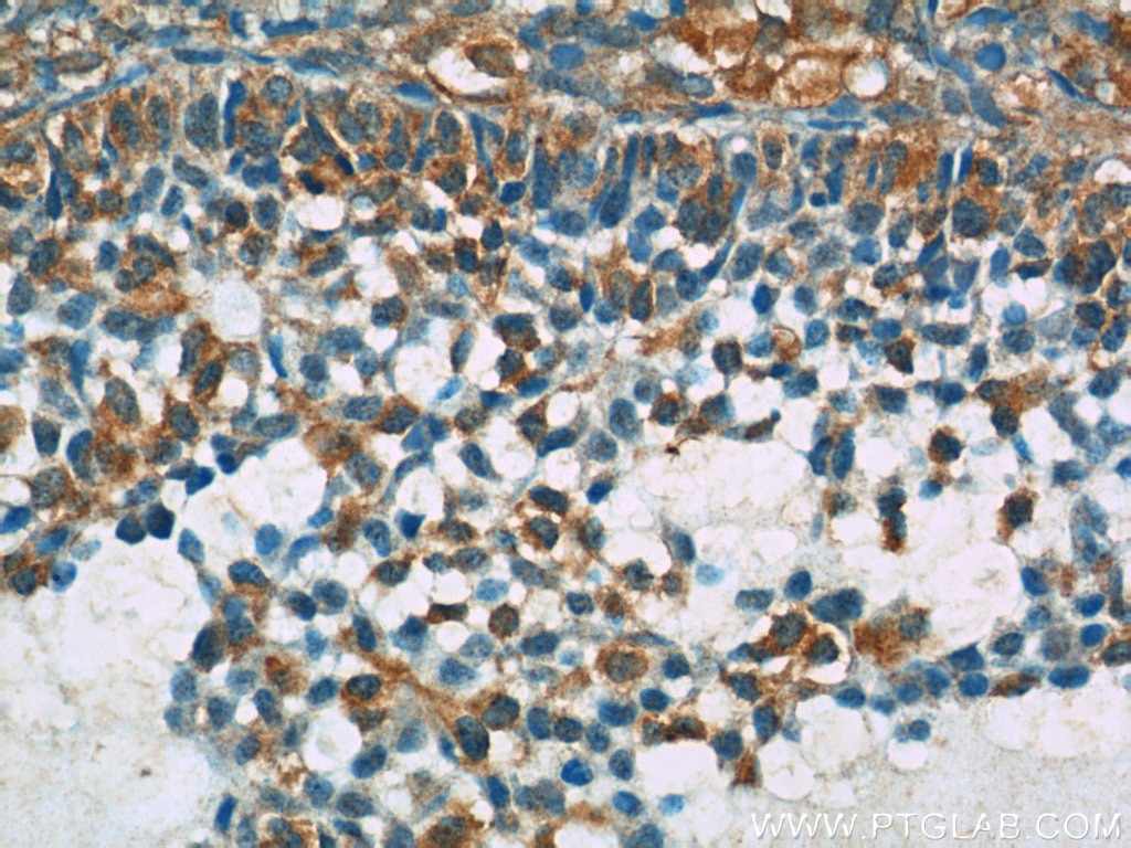 Immunohistochemistry (IHC) staining of human ovary tissue using BIVM Polyclonal antibody (25432-1-AP)