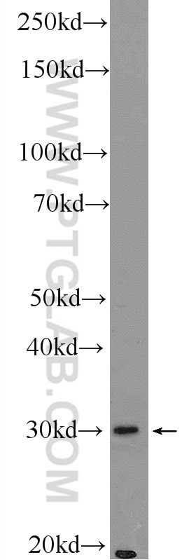 Western Blot (WB) analysis of Raji cells using BIVM Polyclonal antibody (25432-1-AP)