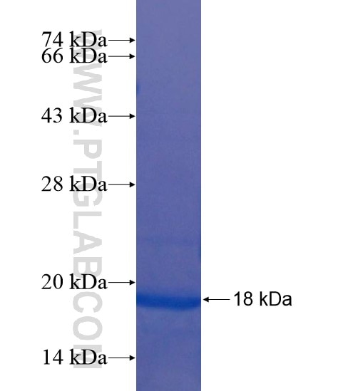 BIVM fusion protein Ag22087 SDS-PAGE