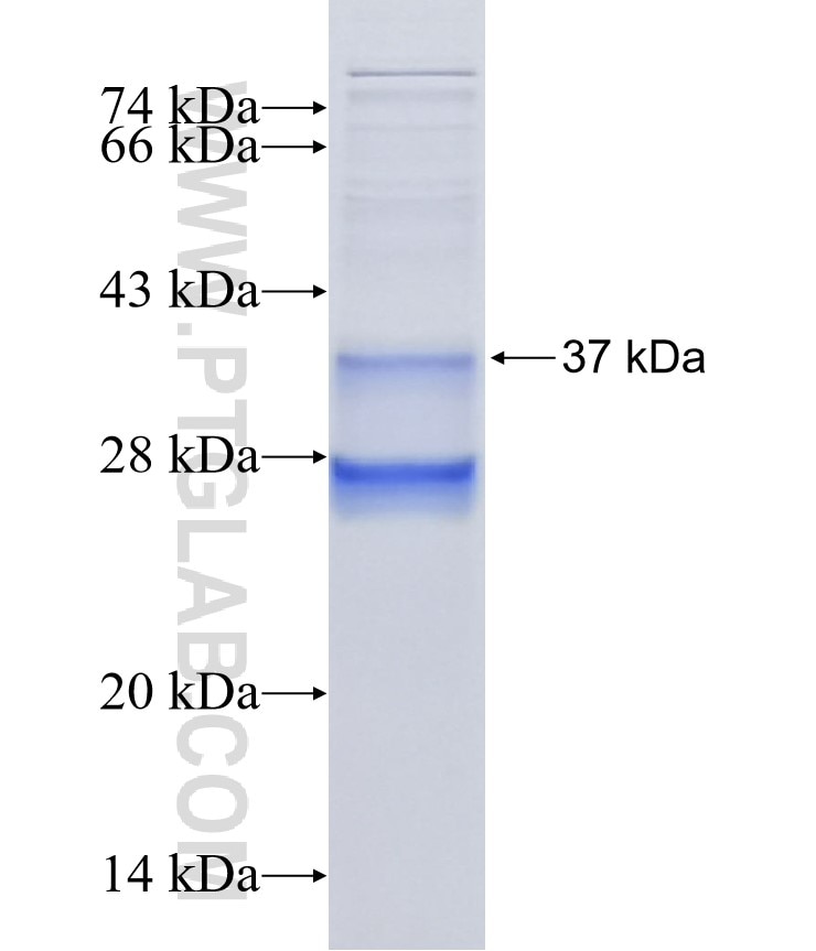 BLCAP fusion protein Ag5456 SDS-PAGE
