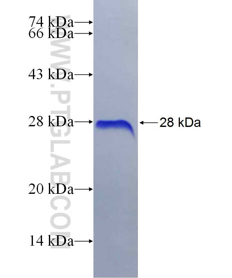 BLIMP1 fusion protein Ag29956 SDS-PAGE BLIMP1 fusion protein Ag29956 SDS-PAGE