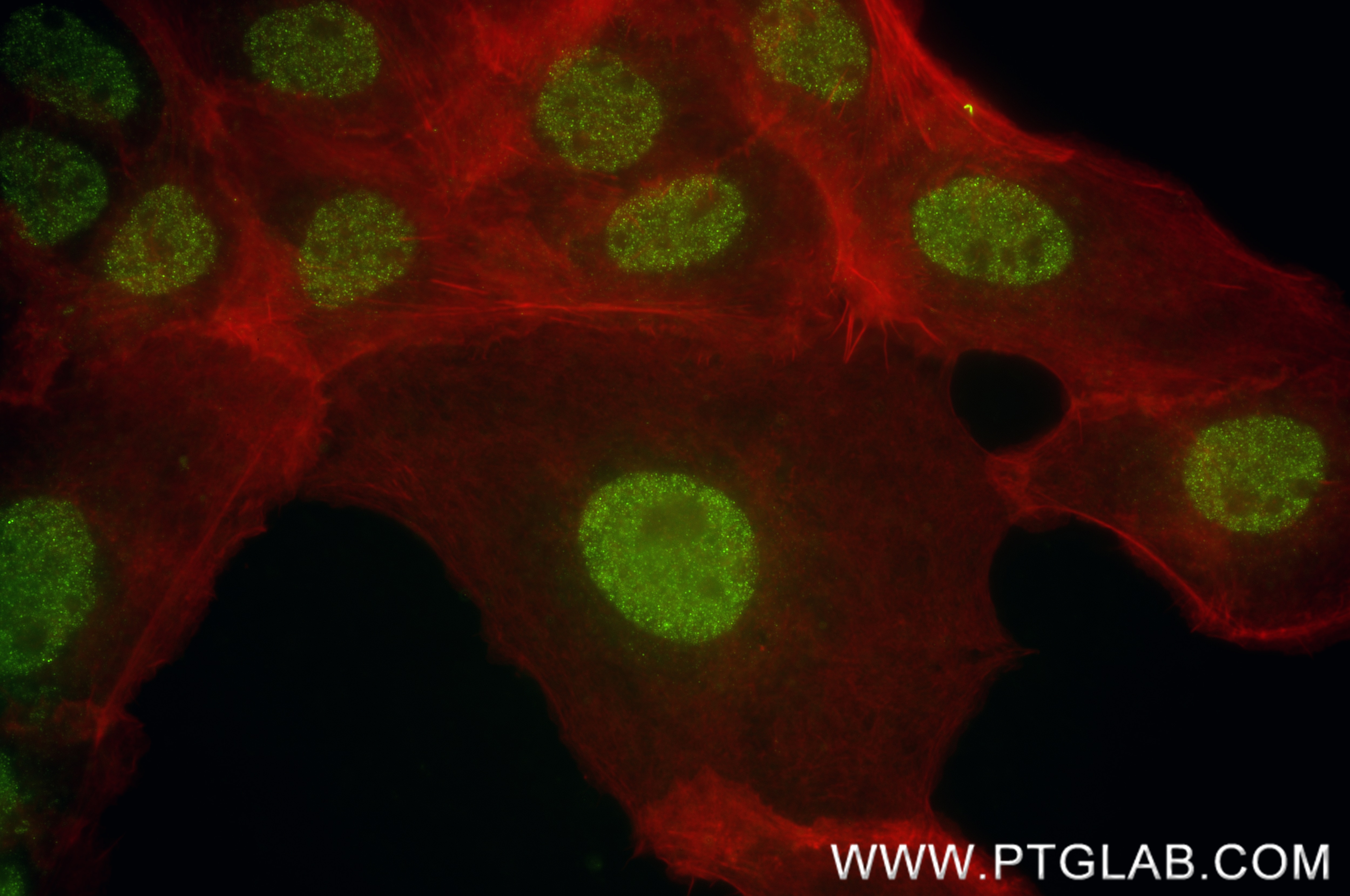 Immunofluorescence (IF) / fluorescent staining of A431 cells using BLIMP1/PRDM1 Recombinant antibody (84625-3-RR)