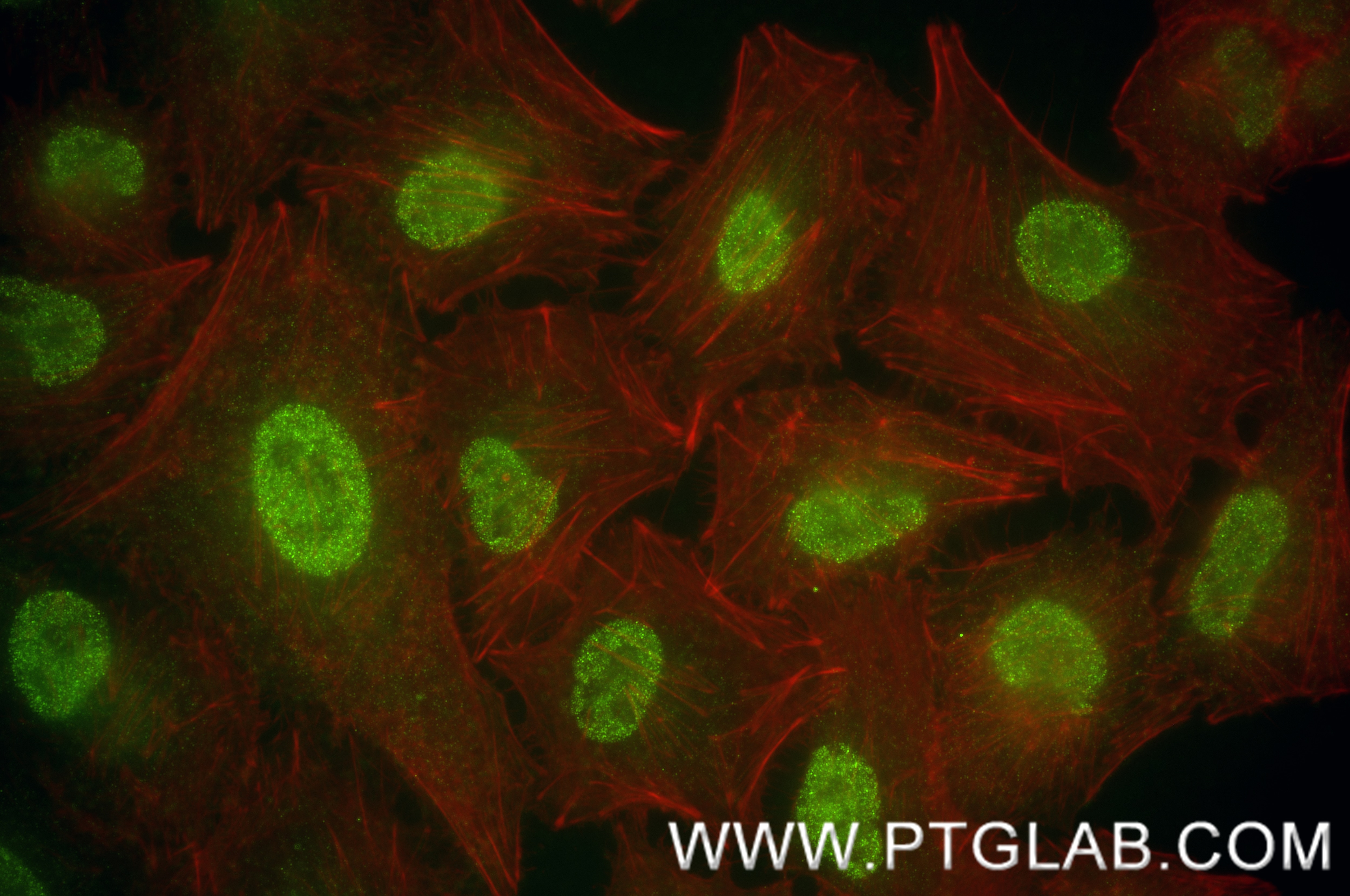 Immunofluorescence (IF) / fluorescent staining of A549 cells using BLIMP1/PRDM1 Recombinant antibody (84625-3-RR)