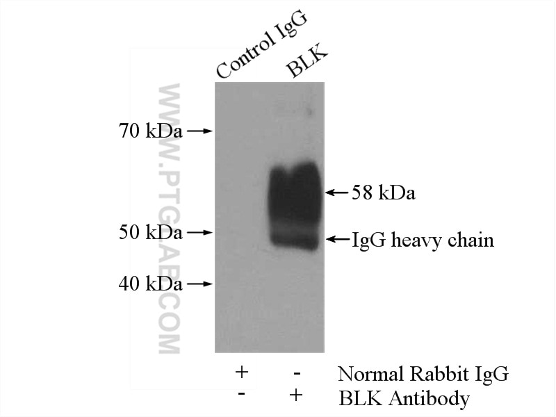 Immunoprecipitation (IP) experiment of SH-SY5Y cells using BLK Polyclonal antibody (10510-1-AP)