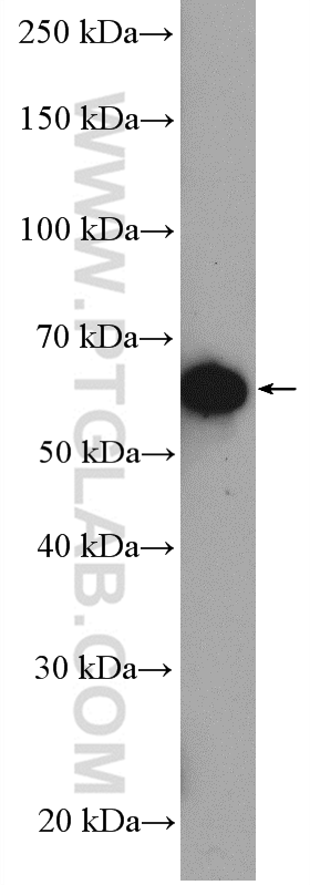 Western Blot (WB) analysis of Jurkat cells using BLK Polyclonal antibody (10510-1-AP)