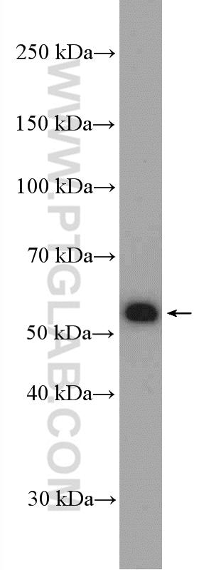 Western Blot (WB) analysis of Raji cells using BLK Polyclonal antibody (10510-1-AP)