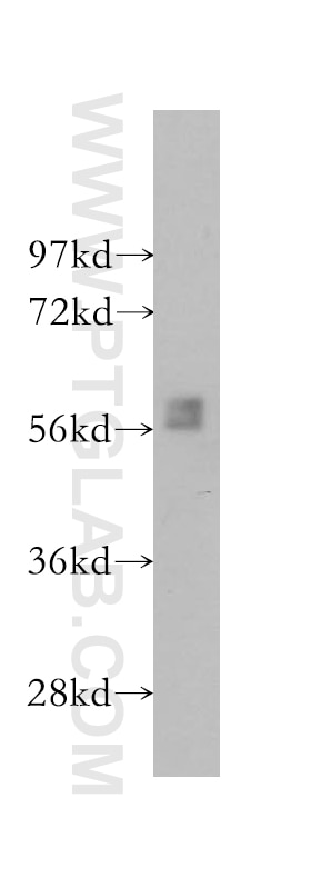Western Blot (WB) analysis of SH-SY5Y cells using BLK Polyclonal antibody (10510-1-AP)