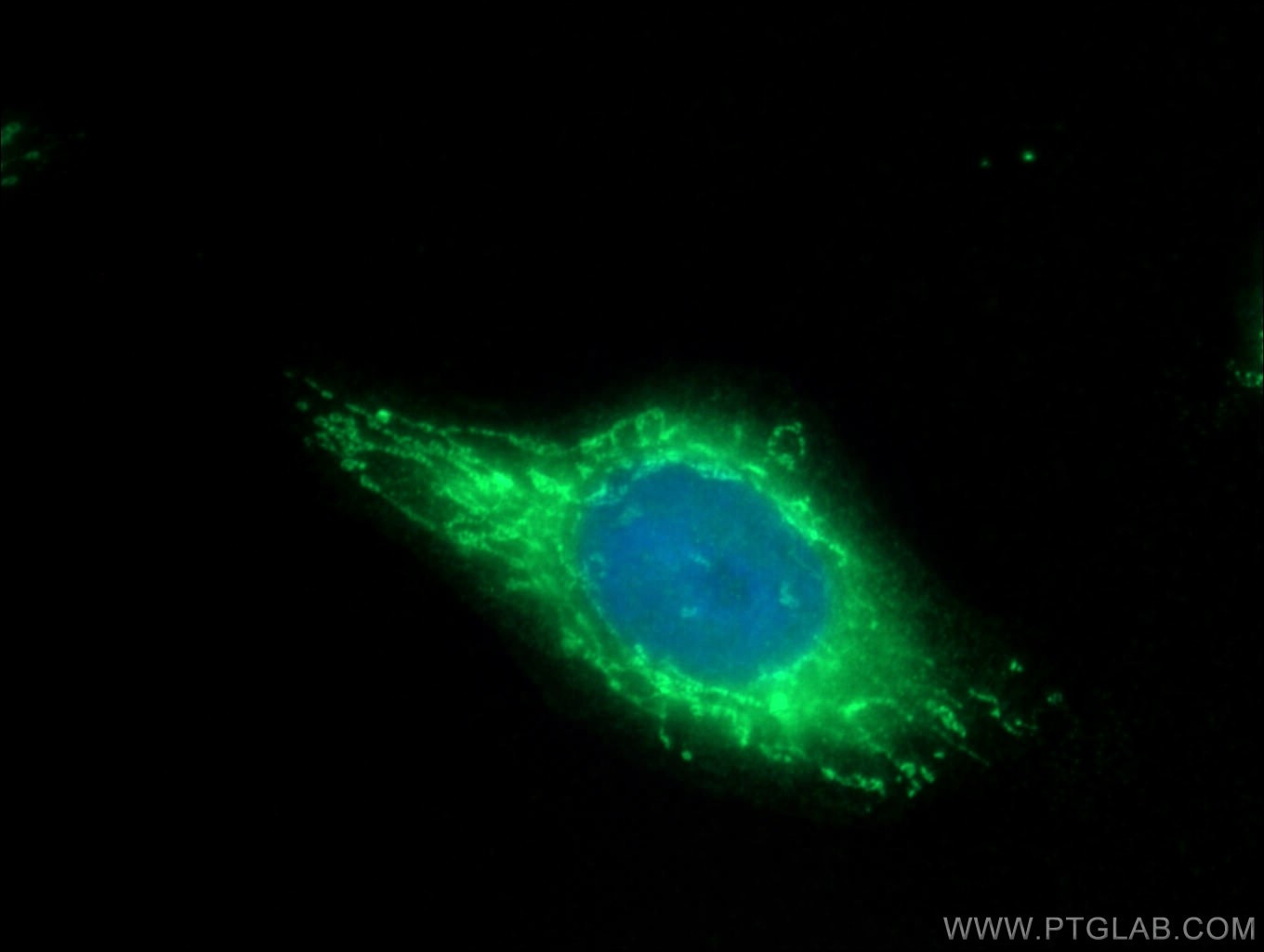 Immunofluorescence (IF) / fluorescent staining of HeLa cells using BLMH Polyclonal antibody (14941-1-AP)