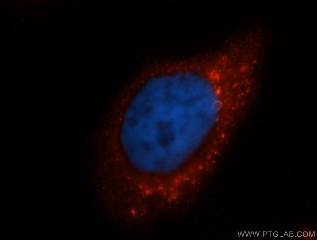 Immunofluorescence (IF) / fluorescent staining of HeLa cells using BLMH Polyclonal antibody (14941-1-AP)