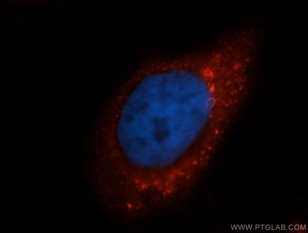 IF Staining of HeLa using 14941-1-AP