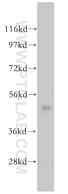 Western Blot (WB) analysis of mouse spleen tissue using BLMH Polyclonal antibody (14941-1-AP)