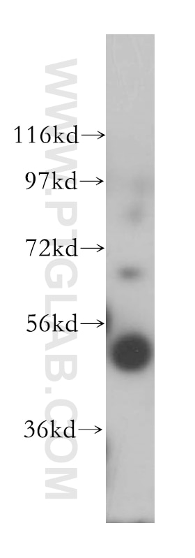 Western Blot (WB) analysis of human colon tissue using BLMH Polyclonal antibody (14941-1-AP)