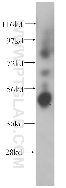 Western Blot (WB) analysis of mouse pancreas tissue using BLMH Polyclonal antibody (14941-1-AP)