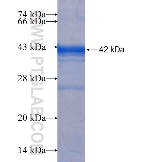 BLMH fusion protein Ag6749 SDS-PAGE