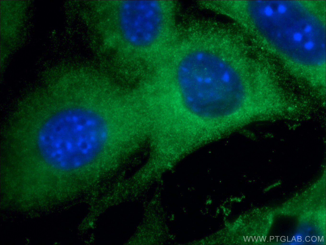 Immunofluorescence (IF) / fluorescent staining of NIH/3T3 cells using BLNK Polyclonal antibody (10855-1-AP)