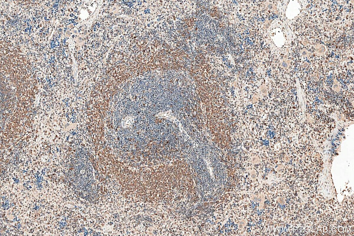 Immunohistochemistry (IHC) staining of rat spleen tissue using BLNK Polyclonal antibody (10855-1-AP)
