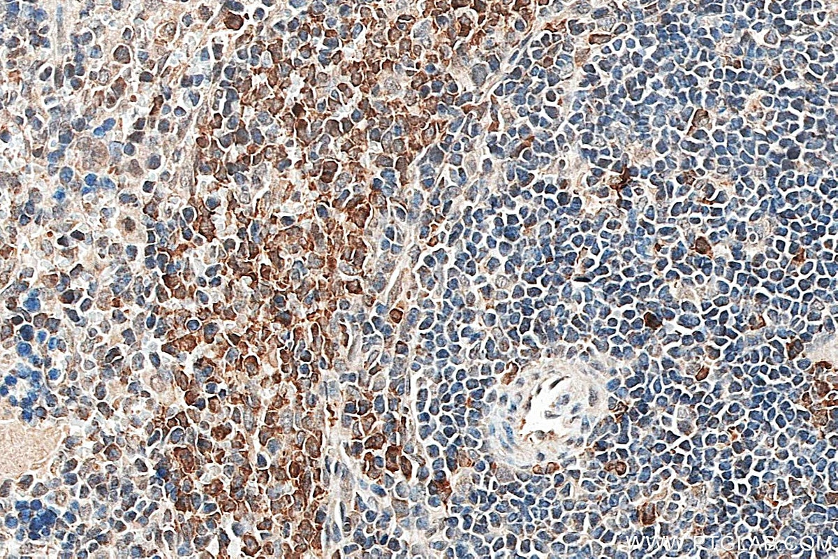 Immunohistochemistry (IHC) staining of rat spleen tissue using BLNK Polyclonal antibody (10855-1-AP)