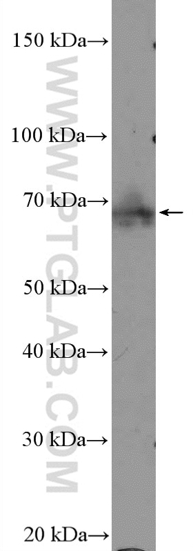 Western Blot (WB) analysis of Ramos cells using BLNK Polyclonal antibody (10855-1-AP)